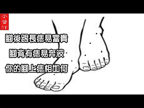 右腳踝有痣|痣說人生:腳上痣的位置與命運圖